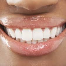 teeth-whitening-in-lekki